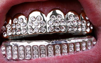 [AFBLIJVEN] Vergeetachtig aan het worden alsof je dementie hebt? Misschien ligt het aan je bling